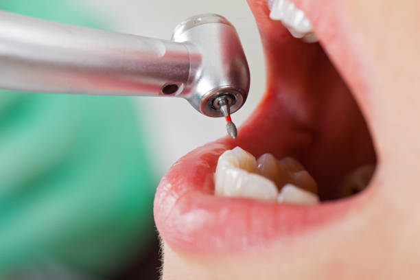 Best Walk-In Emergency Dentist in Bluff City, TN